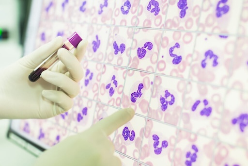 Abnormal blood report